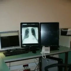 W ustalonym terminie pacjent, z dokumentem potwierdzającym tożsamość, zgłasza się do rejestracji Zakładu Radiologii w celu uzupełnienia dokumentacji medycznej, po czym kierowany jest do odpowiedniej pracowni.