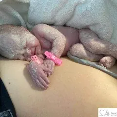 Dzięki umiejętnościom lekarzy Oddział dysponuje szerokim wachlarzem metod leczniczych.